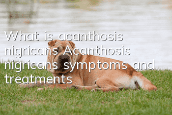 What is acanthosis nigricans? Acanthosis nigricans symptoms and treatments
